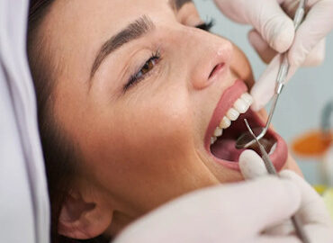 Terapia conservativa dentale