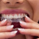 bite-dentale Milano